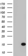 HEK293T cells were transfected with the pCMV6-ENTRY control (Left lane) or pCMV6-ENTRY C11orf67 (Right lane) cDNA for 48 hrs and lysed. Equivalent amounts of cell lysates (5 ug per lane) were separated by SDS-PAGE and immunoblotted with anti-C11orf67.