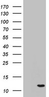 HEK293T cells were transfected with the pCMV6-ENTRY control (Left lane) or pCMV6-ENTRY C11orf67 (Right lane) cDNA for 48 hrs and lysed. Equivalent amounts of cell lysates (5 ug per lane) were separated by SDS-PAGE and immunoblotted with anti-C11orf67.