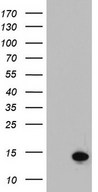 HEK293T cells were transfected with the pCMV6-ENTRY control (Left lane) or pCMV6-ENTRY C11orf67 (Right lane) cDNA for 48 hrs and lysed. Equivalent amounts of cell lysates (5 ug per lane) were separated by SDS-PAGE and immunoblotted with anti-C11orf67.
