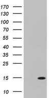 HEK293T cells were transfected with the pCMV6-ENTRY control (Left lane) or pCMV6-ENTRY C11orf67 (Right lane) cDNA for 48 hrs and lysed. Equivalent amounts of cell lysates (5 ug per lane) were separated by SDS-PAGE and immunoblotted with anti-C11orf67.