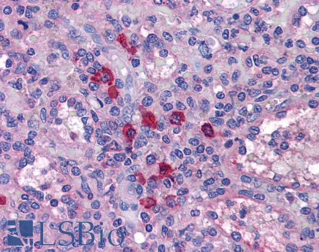 Anti-TLR7 antibody IHC of human spleen. Immunohistochemistry of formalin-fixed, paraffin-embedded tissue after heat-induced antigen retrieval. Antibody LS-B4827 concentration 10 ug/ml.
