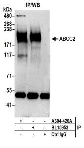Detection of Human ABCC2 by Western Blot of Immunoprecipitates. Samples: Whole cell lysate (1 mg for IP; 20% of IP loaded) prepared using NETN buffer from HepG2 cells. Antibodies: Affinity purified rabbit anti-ABCC2 antibody used for IP at 6 ug per reaction. ABCC2 was also immunoprecipitated by rabbit anti-ABCC2 antibody BL15953. For blotting immunoprecipitated ABCC2, was used at 1 ug/ml. Detection: Chemiluminescence with an exposure time of 3 minutes.