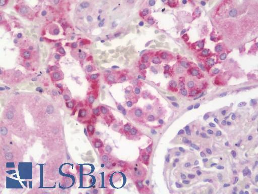 Anti-ABCC2 / MRP2 antibody IHC staining of human kidney. Immunohistochemistry of formalin-fixed, paraffin-embedded tissue after heat-induced antigen retrieval. Antibody LS-B10445 concentration 5 ug/ml.