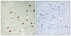 IHC of paraffin-embedded human brain tissue, using ABHD14B Antibody. The picture on the right is treated with the synthesized peptide.