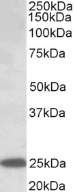 ABHD14B antibody (0.3 ug/ml) staining of Liver lysate (35 ug protein in RIPA buffer). Primary incubation was 1 hour. Detected by chemiluminescence.