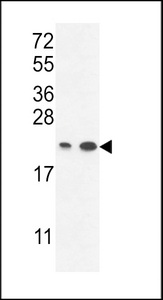 ABHEB Antibody western blot of A2058,T47D cell line lysates (35 ug/lane). The ABHEB antibody detected the ABHEB protein (arrow).