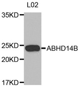 Western blot analysis of extracts of L02 cell line, using ABHD14B antibody.
