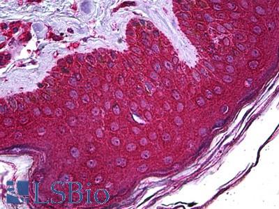 Anti-ABHD5 / CGI-58 antibody IHC of human skin. Immunohistochemistry of formalin-fixed, paraffin-embedded tissue after heat-induced antigen retrieval. Antibody LS-B5751 concentration 5 ug/ml.