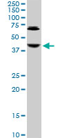 ABHD5 monoclonal antibody, clone 1F3. Western blot of ABHD5 expression in Jurkat.