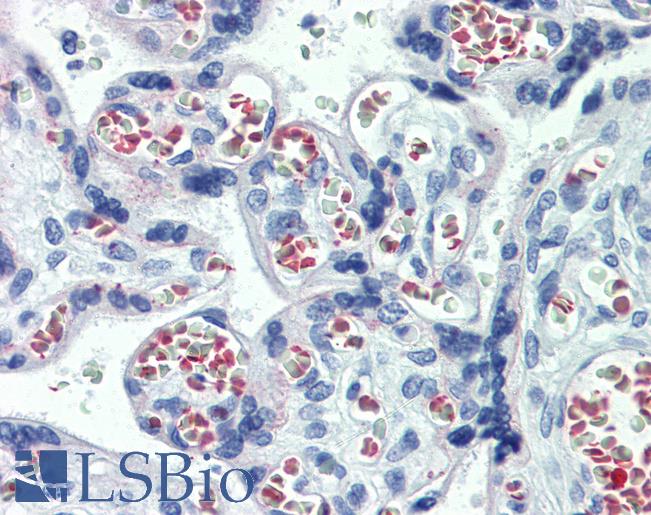 Anti-ABHD5 / CGI-58 antibody IHC of human placenta. Immunohistochemistry of formalin-fixed, paraffin-embedded tissue after heat-induced antigen retrieval. Antibody LS-B3990 concentration 10 ug/ml.