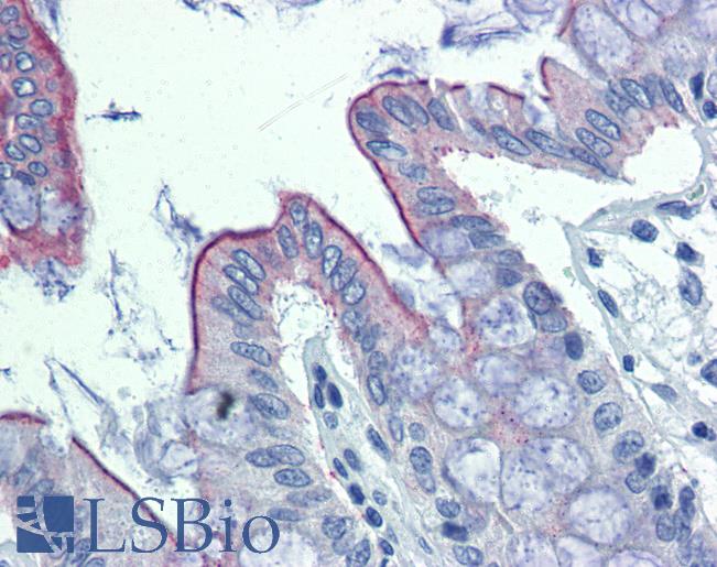 Anti-ABHD5 / CGI-58 antibody IHC of human colon. Immunohistochemistry of formalin-fixed, paraffin-embedded tissue after heat-induced antigen retrieval. Antibody LS-B3990 concentration 10 ug/ml.