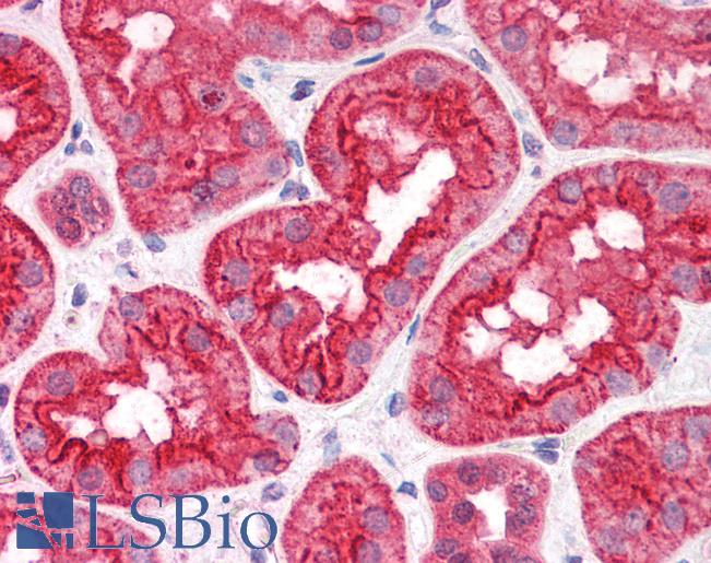 Anti-ABHD5 / CGI-58 antibody IHC of human kidney. Immunohistochemistry of formalin-fixed, paraffin-embedded tissue after heat-induced antigen retrieval. Antibody LS-B4458 concentration 3.75 ug/ml.