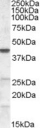 ABHD5 (0.2 ug/ml) staining of NIH3T3 lysate (35 ug protein in RIPA buffer). Primary incubation was 1 hour. Detected by chemiluminescence.