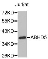 Western blot analysis of extracts of Jurkat cell line, using ABHD5 antibody.