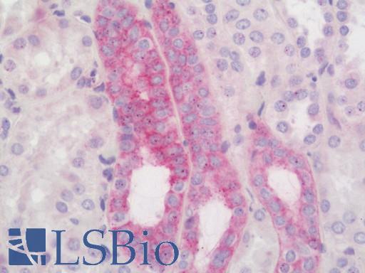 Human Kidney: Formalin-Fixed, Paraffin-Embedded (FFPE)
