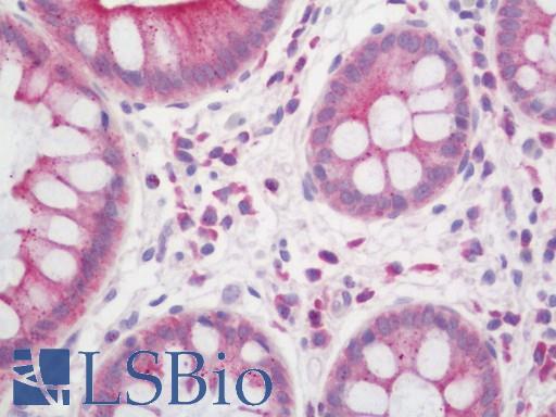 Human Colon: Formalin-Fixed, Paraffin-Embedded (FFPE)