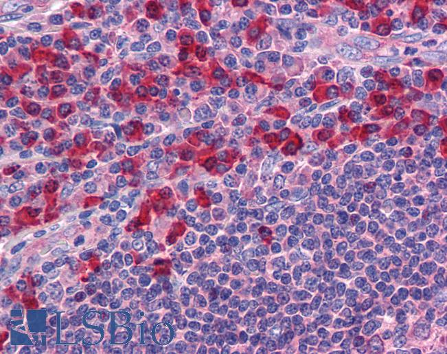 Anti-TLR7 antibody IHC of human tonsil. Immunohistochemistry of formalin-fixed, paraffin-embedded tissue after heat-induced antigen retrieval. Antibody LS-B4827 concentration 10 ug/ml.