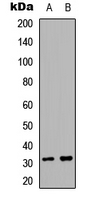 Western blot analysis of ACER2 expression in A549.MCF7 (A); PC12 (B) whole cell lysates.