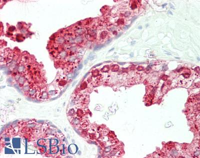 Human Prostate: Formalin-Fixed, Paraffin-Embedded (FFPE)