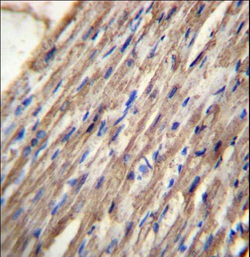C10orf129 Antibody immunohistochemistry of formalin-fixed and paraffin-embedded human heart tissue followed by peroxidase-conjugated secondary antibody and DAB staining.