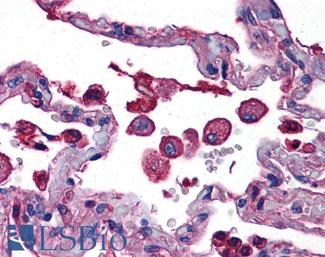 Anti-TLR7 antibody IHC of human lung. Immunohistochemistry of formalin-fixed, paraffin-embedded tissue after heat-induced antigen retrieval. Antibody LS-B4827 concentration 10 ug/ml.