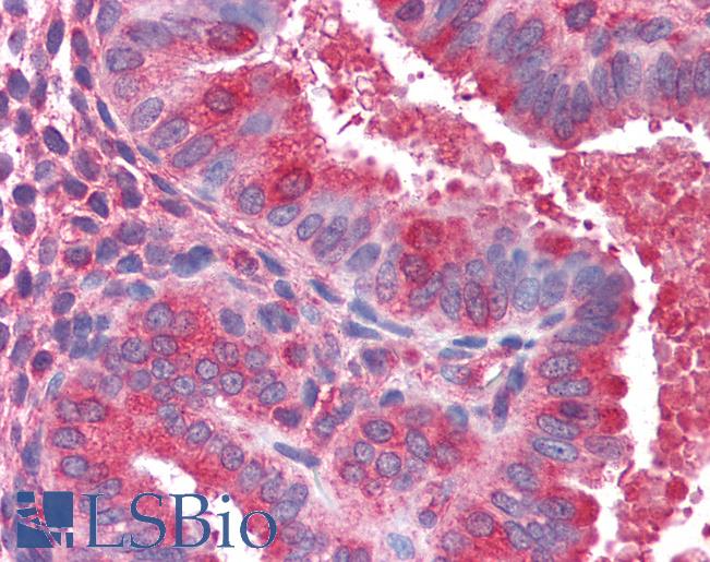 Anti-ACTR1B antibody IHC of human uterus. Immunohistochemistry of formalin-fixed, paraffin-embedded tissue after heat-induced antigen retrieval. Antibody LS-B2753 concentration 75 ug/ml.