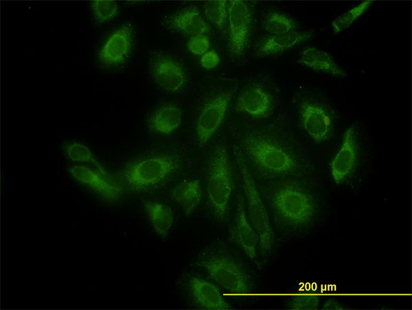 Immunofluorescence of monoclonal antibody to ACTR3 on HeLa cell. [antibody concentration 10 ug/ml]