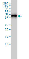 ACTR3 monoclonal antibody (M02), clone 2B6 Western blot of ACTR3 expression in A-431.