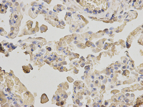 Immunohistochemistry of paraffin-embedded human lung using ACTR3 antibody at dilution of 1:200 (400x lens).