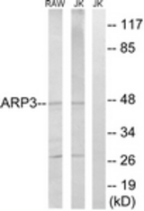 Western blot of extracts from Jurkat/RAW264.7 cells, using ACTR3 Antibody. The lane on the right is treated with the synthesized peptide.
