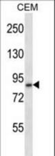 ADAM11 Antibody western blot of CEM cell line lysates (35 ug/lane). The ADAM11 antibody detected the ADAM11 protein (arrow).