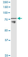 ADAM11 monoclonal antibody (M01), clone 3D4. Western Blot analysis of ADAM11 expression in human colon.