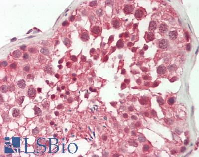 Human Testis: Formalin-Fixed, Paraffin-Embedded (FFPE)