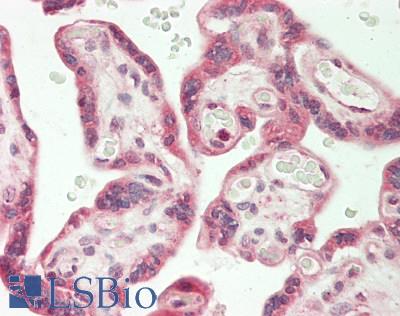 Human Placenta: Formalin-Fixed, Paraffin-Embedded (FFPE)