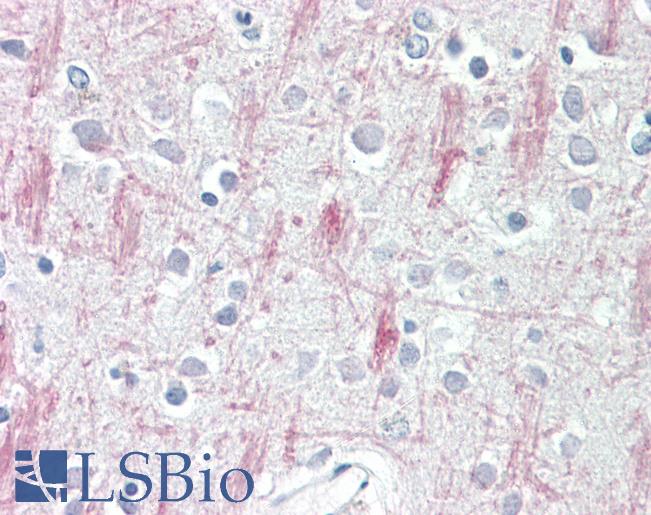 Anti-GPR125 antibody IHC staining of human brain, cortex. Immunohistochemistry of formalin-fixed, paraffin-embedded tissue after heat-induced antigen retrieval.