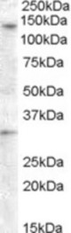 Antibody (0.5 ug/ml) staining of Human Ovary lysate (35 ug protein in RIPA buffer). Primary incubation was 1 hour. Detected by chemiluminescence