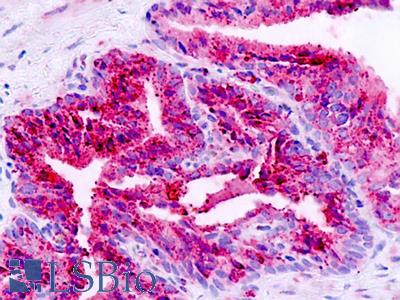 Human Prostate: Formalin-Fixed, Paraffin-Embedded (FFPE)