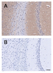 Immunohistochemistry-Paraffin: BAI1 Antibody - A. Staining of mouse brain. B. Blocking of staining using control peptide.