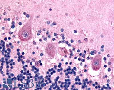 Anti-BAI1 antibody LS-A991 IHC of human brain, neurons. Immunohistochemistry of formalin-fixed, paraffin-embedded tissue after heat-induced antigen retrieval.