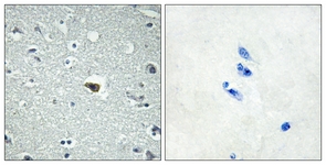 IHC of paraffin-embedded human brain tissue, using BAI1 Antibody. The picture on the right is treated with the synthesized peptide.