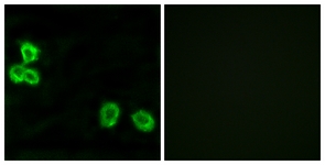 Immunofluorescence of MCF7 cells, using BAI1 Antibody. The picture on the right is treated with the synthesized peptide.