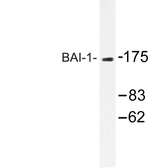 Western blot of BAI-1 (Q732) pAb in extracts from Jurkat treated with HepG2.
