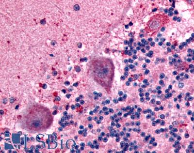Anti-BAI1 antibody LS-A990 IHC of human brain, neurons. Immunohistochemistry of formalin-fixed, paraffin-embedded tissue after heat-induced antigen retrieval.