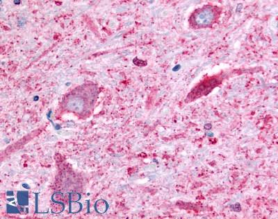 Anti-BAI2 antibody LS-A984 IHC of human brain, neurons. Immunohistochemistry of formalin-fixed, paraffin-embedded tissue after heat-induced antigen retrieval.
