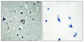 IHC of paraffin-embedded human brain tissue, using BAI2 Antibody. The sample on the right was incubated with synthetic peptide.