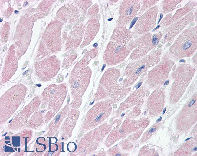 Anti-BAI3 antibody IHC of human heart. Immunohistochemistry of formalin-fixed, paraffin-embedded tissue after heat-induced antigen retrieval. Antibody LS-B3397 concentration 15 ug/ml.