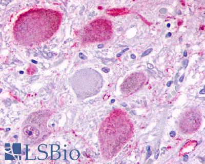 Anti-BAI3 antibody LS-A979 IHC of human brain, neurons. Immunohistochemistry of formalin-fixed, paraffin-embedded tissue after heat-induced antigen retrieval.