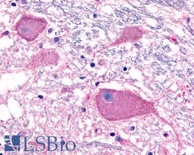 Anti-BAI3 antibody LS-A978 IHC of human brain, neurons. Immunohistochemistry of formalin-fixed, paraffin-embedded tissue after heat-induced antigen retrieval.