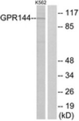 Western blot of extracts from K562 cells, using GPR144 Antibody. The lane on the right is treated with the synthesized peptide.