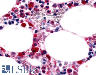 Anti-EMR1 antibody LS-A2678 IHC of human bone marrow. Immunohistochemistry of formalin-fixed, paraffin-embedded tissue after heat-induced antigen retrieval.